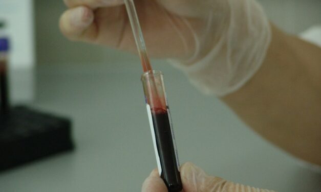 Besplatno testiranje građana na HIV i virus hepatitisa B i C