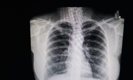 SKRINING ZA RANO OTKRIVANJE RAKA PLUĆA